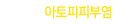 아토피피부염