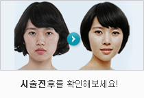 시술전후를 확인해보세요!