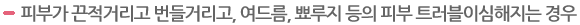피부가 끈적거리고 번들거리고, 여드름, 뾰루지 등의 피부 트러블이심해지는 경우