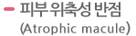 피부 위축성 반점(Atrophic macule)  