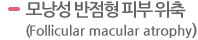 모낭성 반점형 피부 위축(Follicular macular atrophy) 