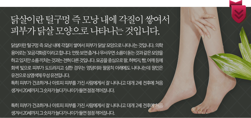 닭살이란 털구멍 즉 모낭 내에 각질이 쌓여서 피부가 닭살 모양으로 나타나는 것입니다. 의학 용어로는 '모공각화증'이라고 합니다. 언뜻 보면 춥거나 무서우면 소름이 돋는 것과 같은 모양을 하고 있지만 소름 끼치는 것과는 전혀 다른 것입니다. 모공을 중심으로 팔, 허벅지, 뺨, 어깨 등에 회색 빛으로 피부가 도드라지고 심한 경우는 엉덩이와 팔꿈치 아래에도 나타나는데 원인은 유전으로 상염색체 우성 유전입니다. 
            특히 피부가 건조하거나 아토피 피부를 가진 사람에게서 잘 나타나고 대개 2세 전후에 처음 생겨서 20세까지 그 숫자가 늘다가 나이가 들면 점점 적어집니다. 