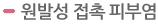 원발성 접촉 피부염