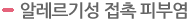 알레르기성 접촉 피부염