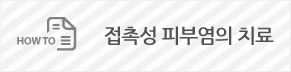 접촉성 피부염의 치료