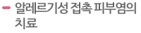 알레르기성 접촉 피부염의 치료