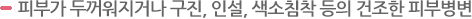 수면부족 