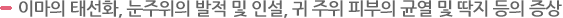 수면부족 