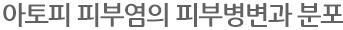 아토피 피부염의 피부병변과 분포