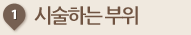 시술하는 부위