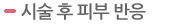 시술 후 피부 반응