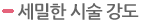 세밀한 시술 강도