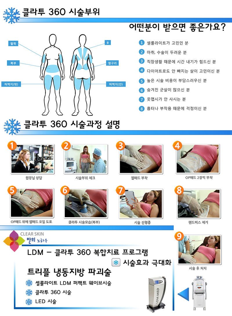 클라투 360 시술부위 및 과정 설명 